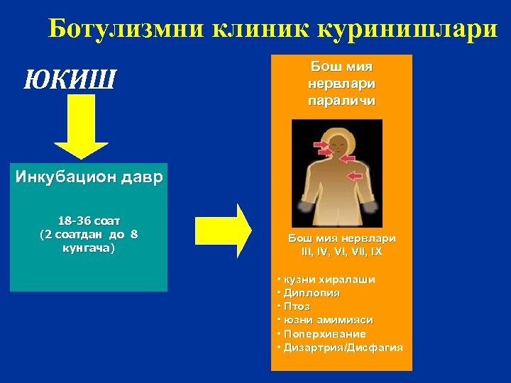 Ботулизмни клиник куринишлари Бош мия нервлари параличи ЮКИШ Инкубацион давр 18 -36 соат (2