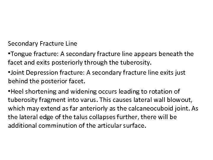 Secondary Fracture Line • Tongue fracture: A secondary fracture line appears beneath the facet
