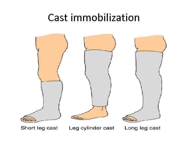 Cast immobilization 