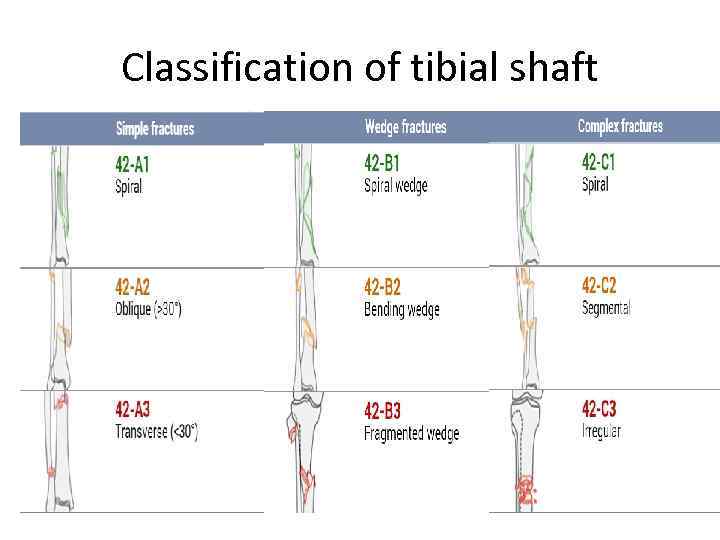 Classification of tibial shaft 