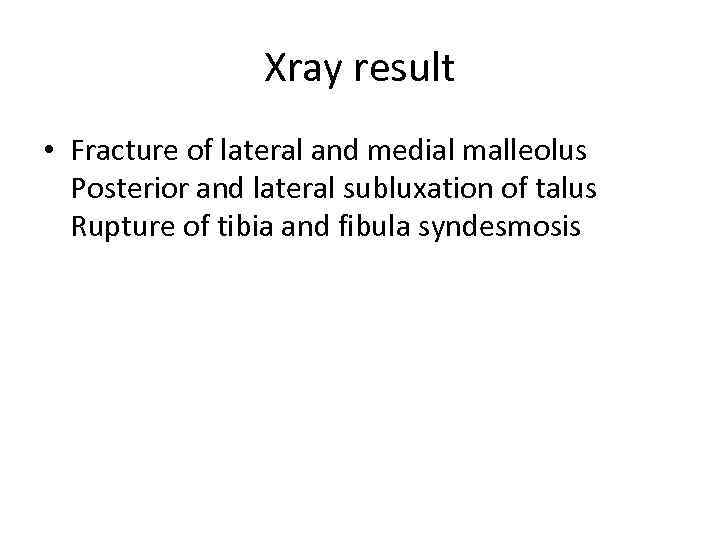 Xray result • Fracture of lateral and medial malleolus Posterior and lateral subluxation of