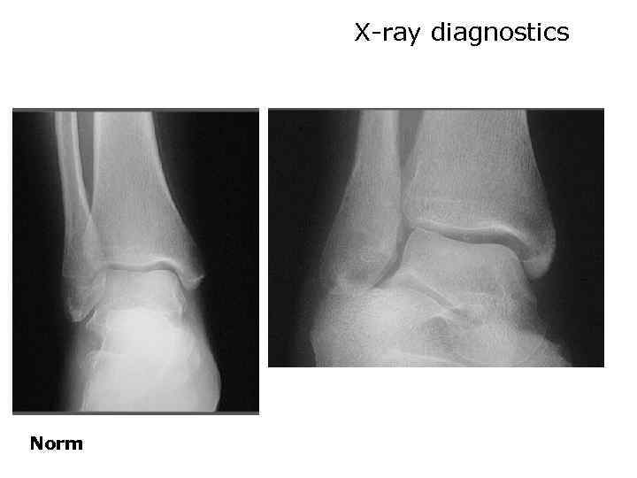 X-ray diagnostics Norm 