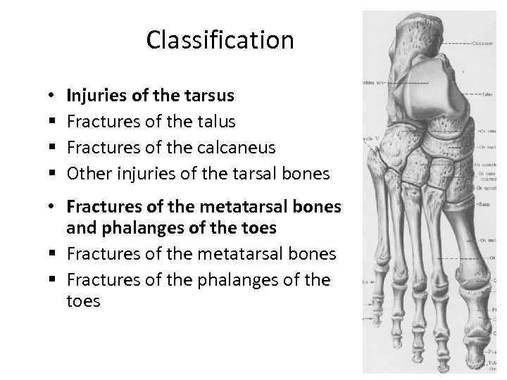 Classification • § § § Injuries of the tarsus Fractures of the talus Fractures