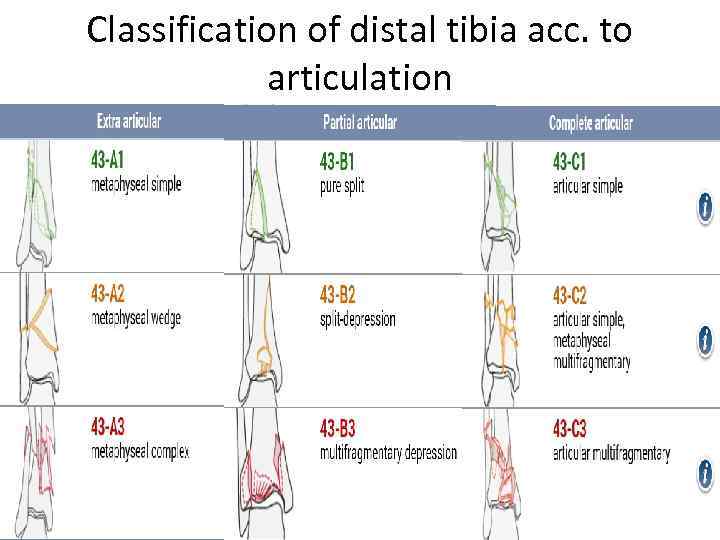 Classification of distal tibia acc. to articulation 
