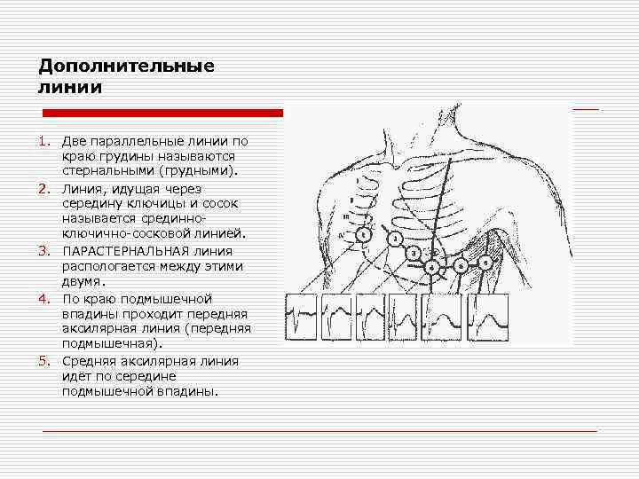 Дополнительные линий