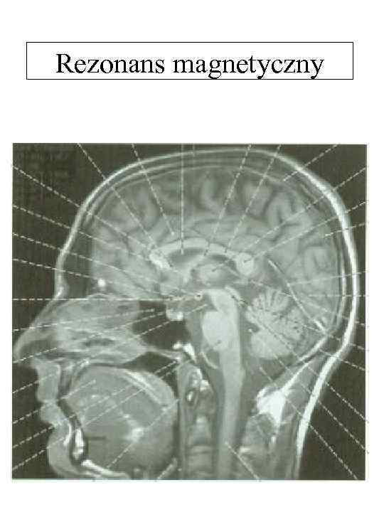 Rezonans magnetyczny 