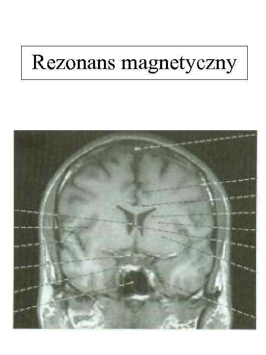 Rezonans magnetyczny 