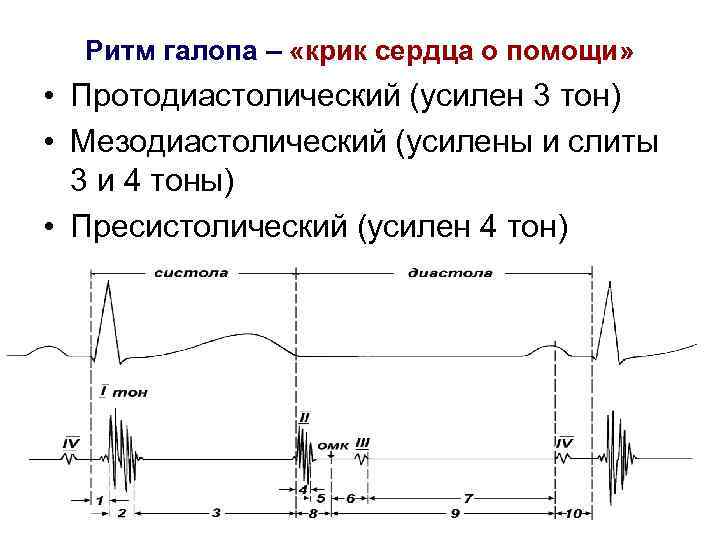 Ритм галопа – «крик сердца о помощи» • Протодиастолический (усилен 3 тон) • Мезодиастолический