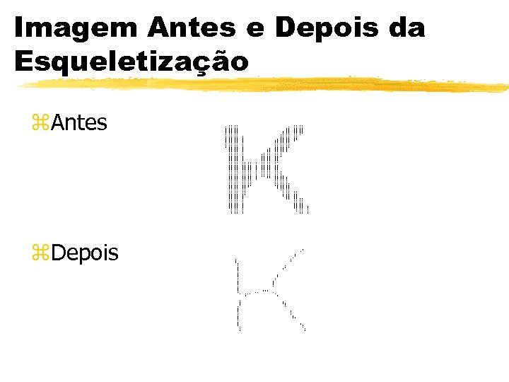 Imagem Antes e Depois da Esqueletização z. Antes z. Depois 
