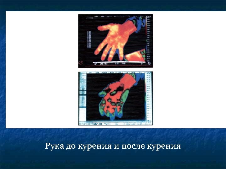 Рука до курения и после курения 