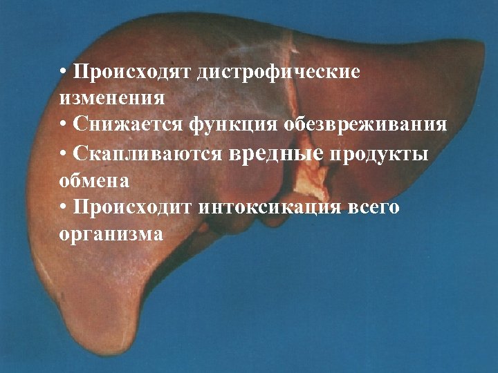  • Происходят дистрофические изменения • Снижается функция обезвреживания • Скапливаются вредные продукты обмена