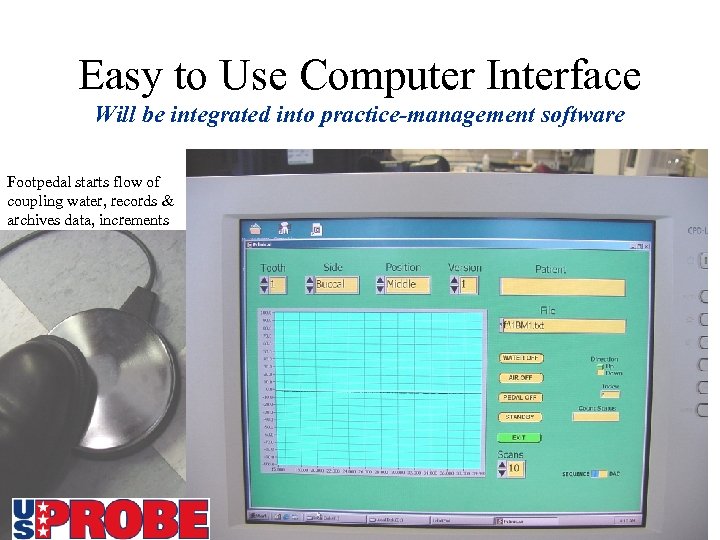 Easy to Use Computer Interface Will be integrated into practice-management software Footpedal starts flow
