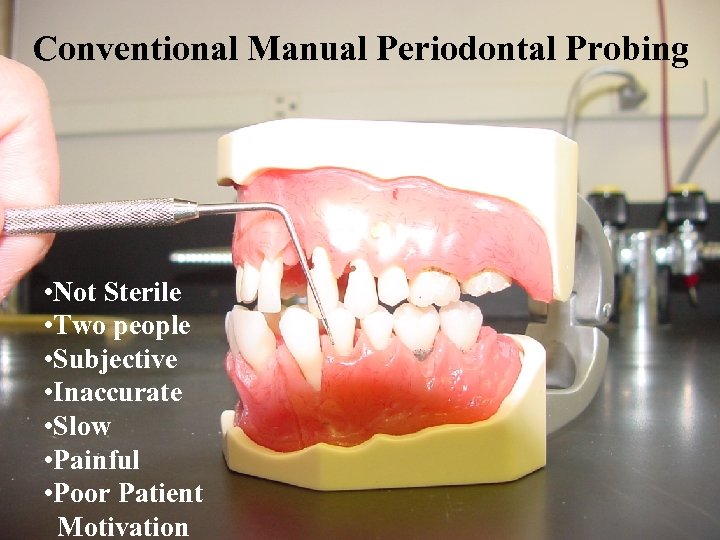 Conventional Manual Periodontal Probing • Not Sterile • Two people • Subjective • Inaccurate