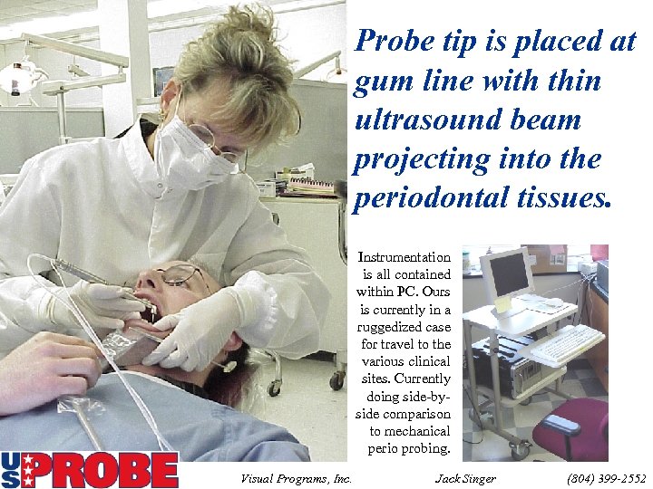 Probe tip is placed at gum line with thin ultrasound beam projecting into the
