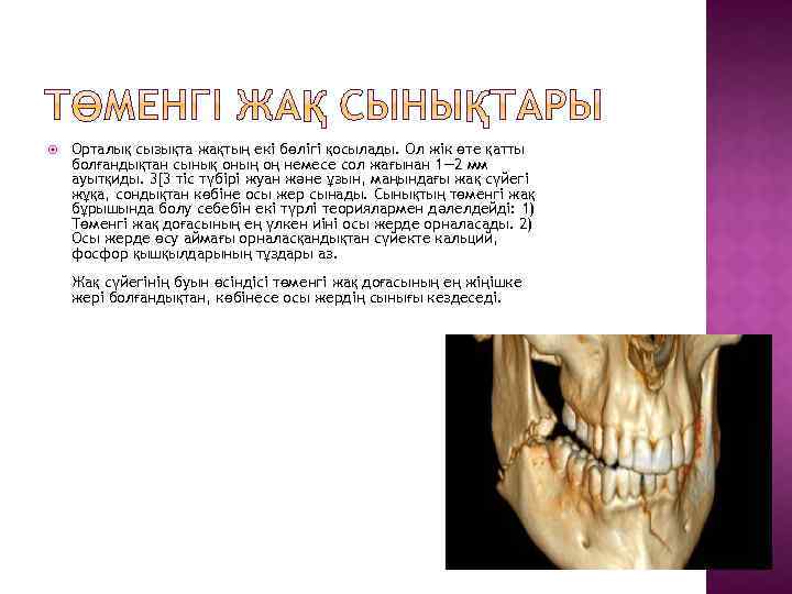  Орталық сызықта жақтың екі бөлігі қосылады. Ол жік өте қатты болғандықтан сынық оның