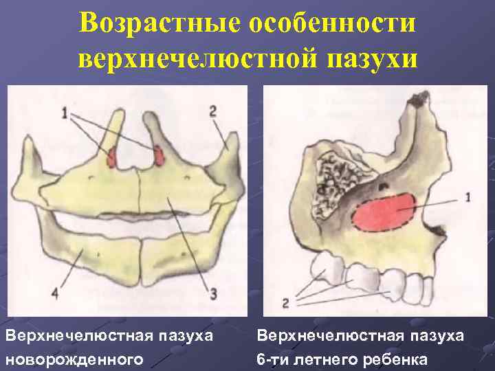 Верхнечелюстная пазуха носа где находится фото