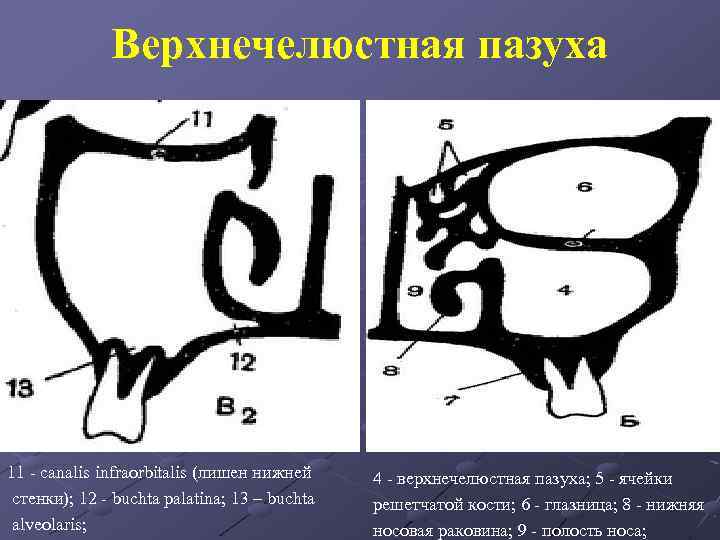 Анатомия верхнечелюстной пазухи презентация