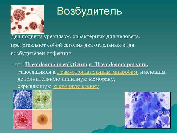 Возбудитель Два подвида уреаплазм, характерных для человека, представляют собой сегодня два отдельных вида возбудителей