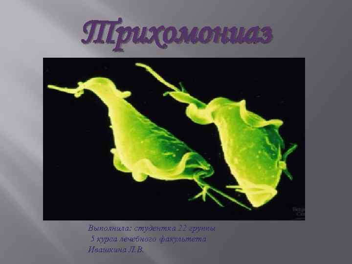 Трихомониаз Выполнила: студентка 22 группы 5 курса лечебного факультета Ивашкина Л. В. 