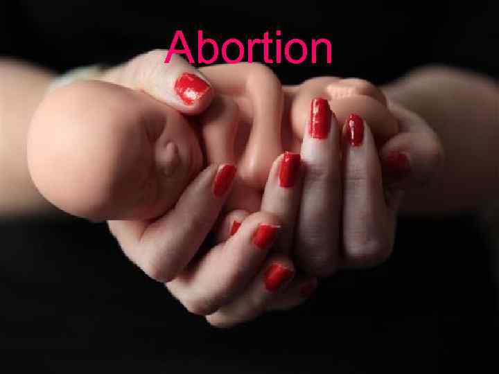 Abortion 