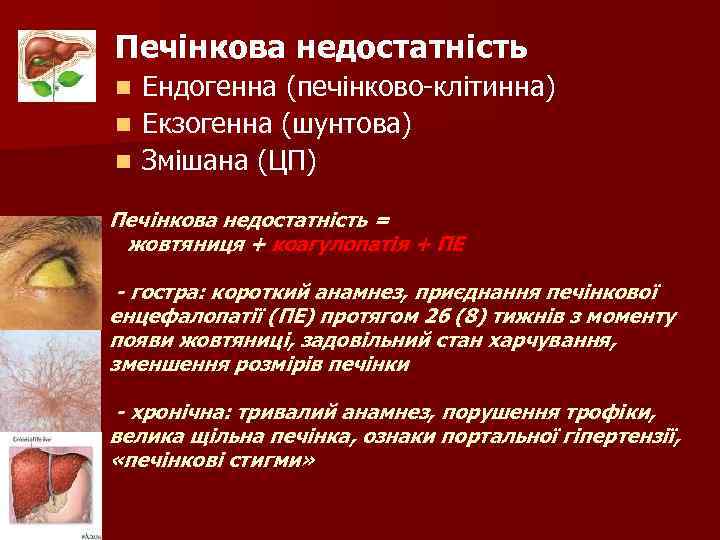 Печінкова недостатність Ендогенна (печінково-клітинна) n Екзогенна (шунтова) n Змішана (ЦП) n Печінкова недостатність =