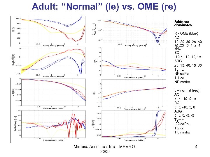 Adult: “Normal” (le) vs. OME (re) • • • R - OME (blue) AC: