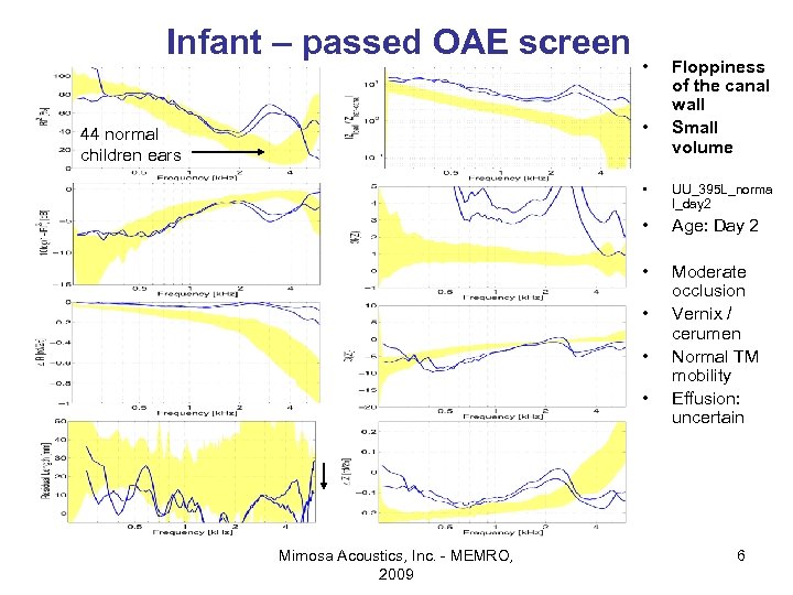 Infant – passed OAE screen • • 44 normal children ears Floppiness of the