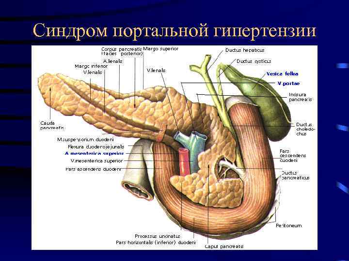Синдром портальной гипертензии 