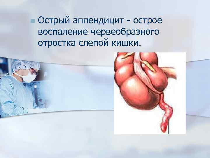 n Острый аппендицит - острое воспаление червеобразного отростка слепой кишки. 