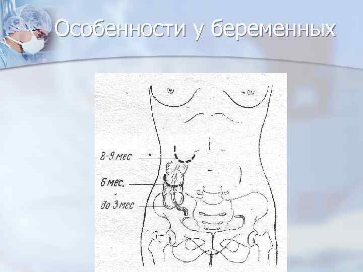 Особенности у беременных 