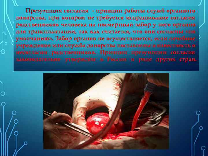 Презумпция согласия - принцип работы служб органного донорства, при котором не требуется испрашивание согласия