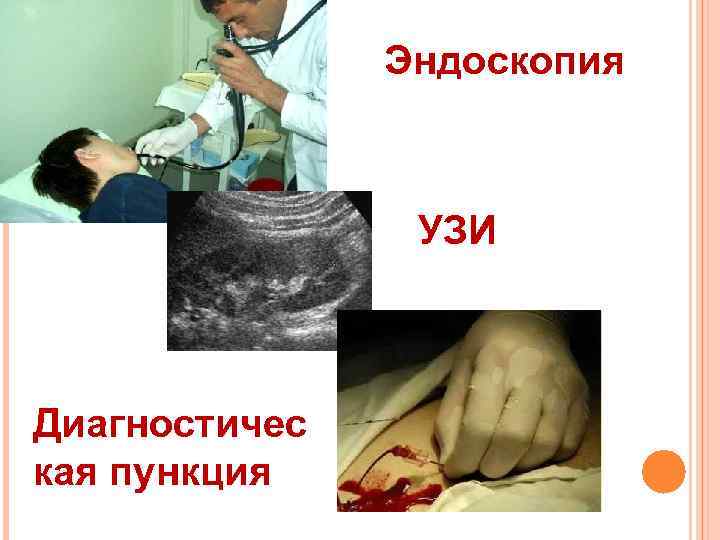 Эндоскопия УЗИ Диагностичес кая пункция 