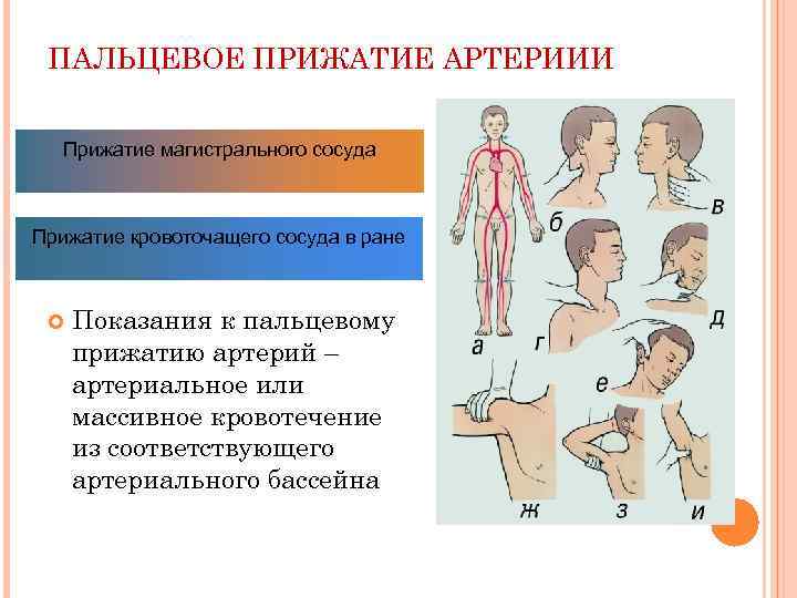 ПАЛЬЦЕВОЕ ПРИЖАТИЕ АРТЕРИИИ Прижатие магистрального сосуда Прижатие кровоточащего сосуда в ране Показания к пальцевому