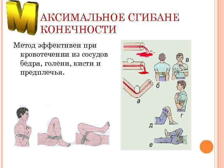 АКСИМАЛЬНОЕ СГИБАНЕ КОНЕЧНОСТИ Метод эффективен при кровотечении из сосудов бедра, голени, кисти и предплечья.