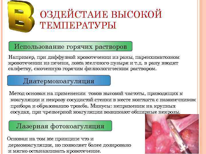 ОЗДЕЙСТАИЕ ВЫСОКОЙ ТЕМПЕРАТУРЫ Использование горячих растворов Например, при диффузной кровотечении из раны, паренхиматозном кровотечении