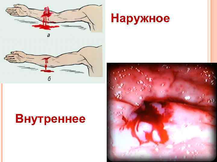 Наружное Внутреннее 