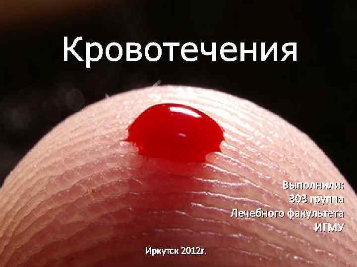 Кровотечения Выполнили: 303 группа Лечебного факультета ИГМУ Иркутск 2012 г. 