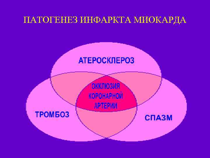 ПАТОГЕНЕЗ ИНФАРКТА МИОКАРДА 