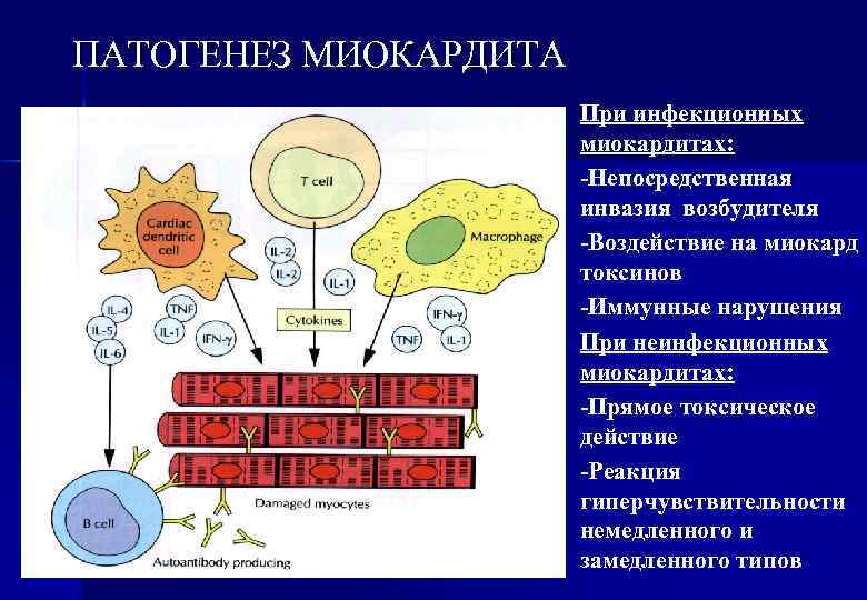 ПАТОГЕНЕЗ МИОКАРДИТА При инфекционных миокардитах: -Непосредственная инвазия возбудителя -Воздействие на миокард токсинов -Иммунные нарушения