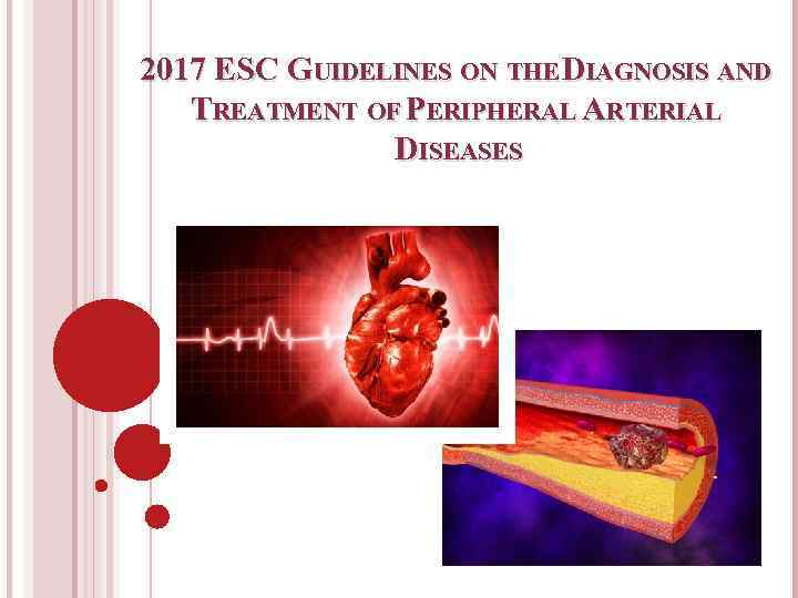 2017 ESC GUIDELINES ON THE DIAGNOSIS AND TREATMENT OF PERIPHERAL ARTERIAL DISEASES 