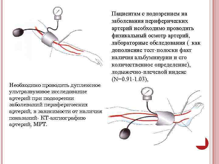 Необходимо проводить дуплексное ультразвуковое исследование артерий при подозрении заболеваний периферических артерий, в зависимости от