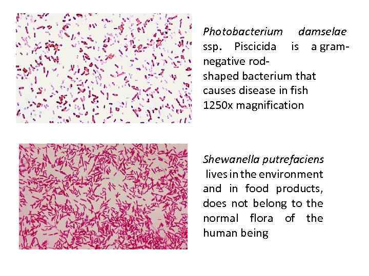 Photobacterium damselae ssp. Piscicida is a gramnegative rodshaped bacterium that causes disease in fish