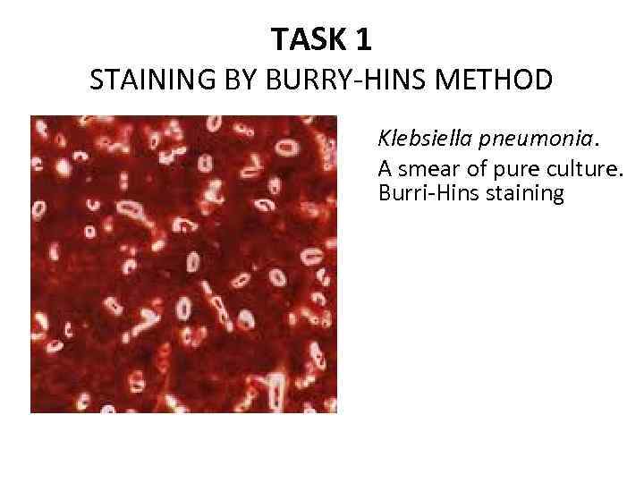 TASK 1 STAINING BY BURRY-HINS METHOD Klebsiella pneumonia. A smear of pure culture. Burri-Hins