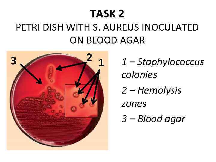 TASK 2 PETRI DISH WITH S. AUREUS INOCULATED ON BLOOD AGAR 3 2 1