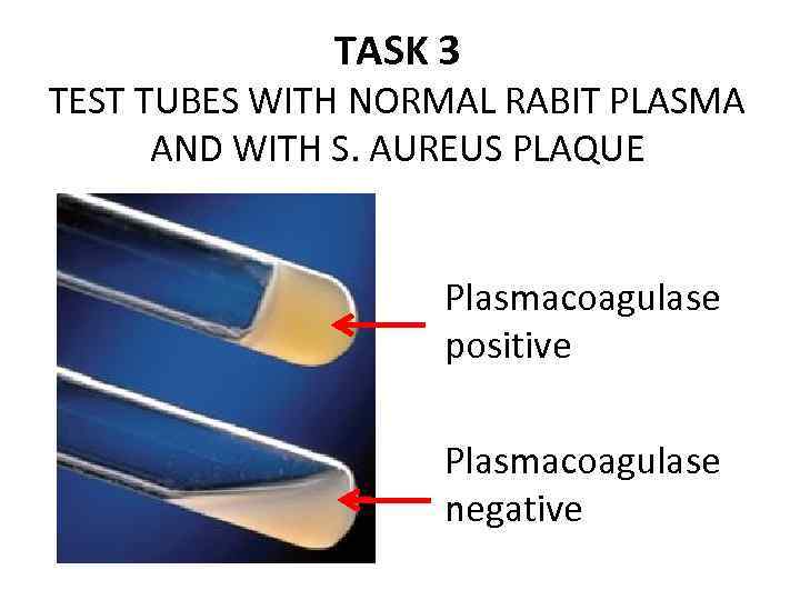 TASK 3 TEST TUBES WITH NORMAL RABIT PLASMA AND WITH S. AUREUS PLAQUE Plasmacoagulase