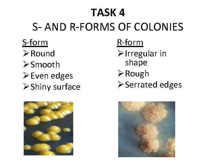 TASK 4 S- AND R-FORMS OF COLONIES S-form Ø Round Ø Smooth Ø Even