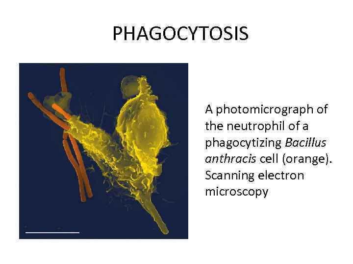 PHAGOCYTOSIS A photomicrograph of the neutrophil of a phagocytizing Bacillus anthracis cell (orange). Scanning