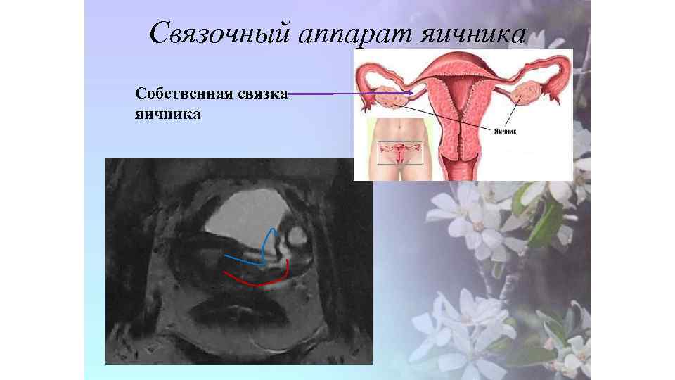 Связочный аппарат яичника Собственная связка яичника 