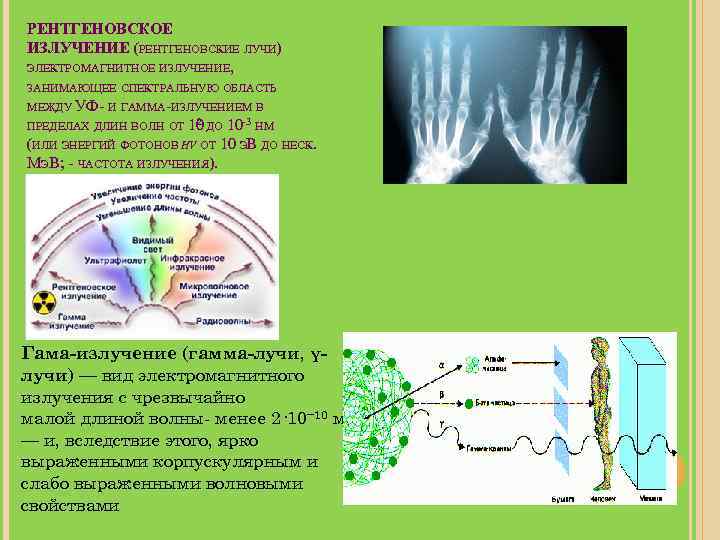 РЕНТГЕНОВСКОЕ ИЗЛУЧЕНИЕ (РЕНТГЕНОВСКИЕ ЛУЧИ) ЭЛЕКТРОМАГНИТНОЕ ИЗЛУЧЕНИЕ, ЗАНИМАЮЩЕЕ СПЕКТРАЛЬНУЮ ОБЛАСТЬ МЕЖДУ УФ- И ГАММА-ИЗЛУЧЕНИЕМ В