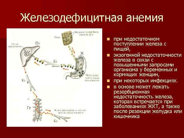 Железодефицитная анемия при недостаточном поступлении железа с пищей, n экзогенной недостаточности железа в связи